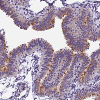 Immunohistochemistry-Paraffin: IFT140 Antibody [NBP2-14116]