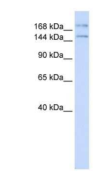 Western Blot: IFT140 Antibody [NBP1-80207]