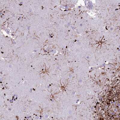 Immunohistochemistry-Paraffin: IFT172 Antibody [NBP1-90686]