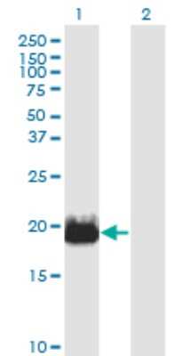 Western Blot: IFT20 Antibody (3F3) [H00090410-M02]