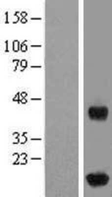 Western Blot: IFT20 Overexpression Lysate [NBL1-11858]