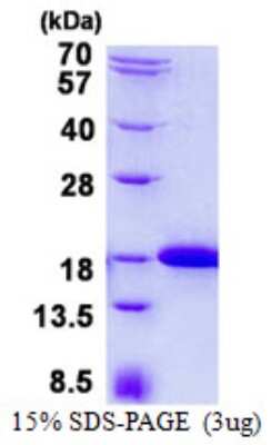 SDS-PAGE: Recombinant Human IFT20 His Protein [NBP2-23152]