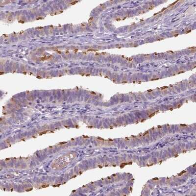 Immunohistochemistry-Paraffin: IFT52 Antibody [NBP2-55756]