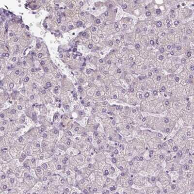 Immunohistochemistry-Paraffin: IFT52 Antibody [NBP2-55756]