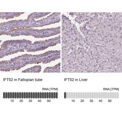 Immunohistochemistry-Paraffin: IFT52 Antibody [NBP2-55756]