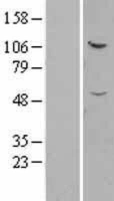 Western Blot: IFT52 Overexpression Lysate [NBL1-11859]