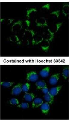 Immunocytochemistry/ Immunofluorescence: IFT74 Antibody [NBP1-31097]