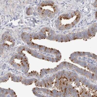 Immunohistochemistry-Paraffin: IFT74 Antibody [NBP1-86580]