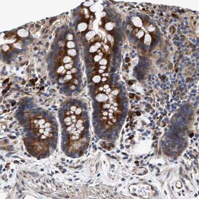 Immunohistochemistry-Paraffin: IFT74 Antibody [NBP1-86581]