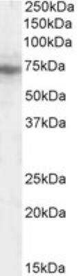 Western Blot: IFT74 Antibody [NB300-822]