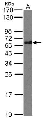 Western Blot: IFT74 Antibody [NBP1-31097]