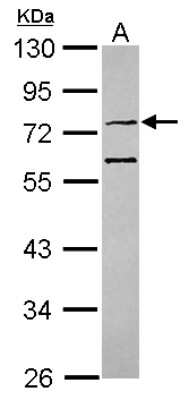 Western Blot: IFT74 Antibody [NBP2-16926]