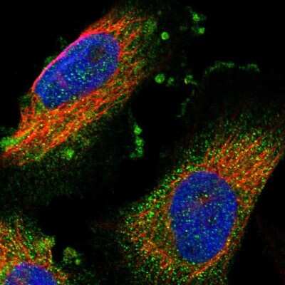 Immunocytochemistry/ Immunofluorescence: IFT81 Antibody [NBP1-84557]