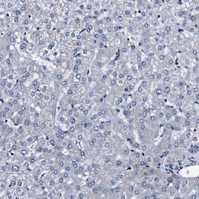 Immunohistochemistry-Paraffin: IFT81 Antibody [NBP1-84557]