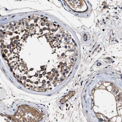 Immunohistochemistry-Paraffin: IFT81 Antibody [NBP1-84557]
