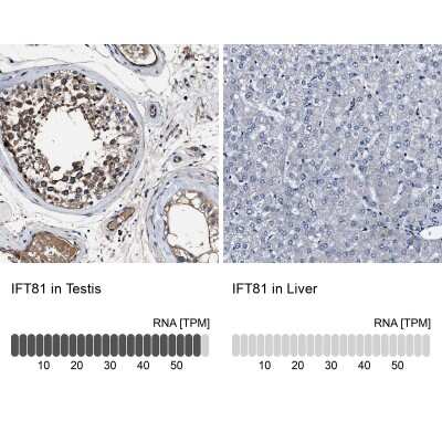 Immunohistochemistry-Paraffin: IFT81 Antibody [NBP1-84557]