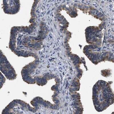 Immunohistochemistry-Paraffin: IFT81 Antibody [NBP1-84558]