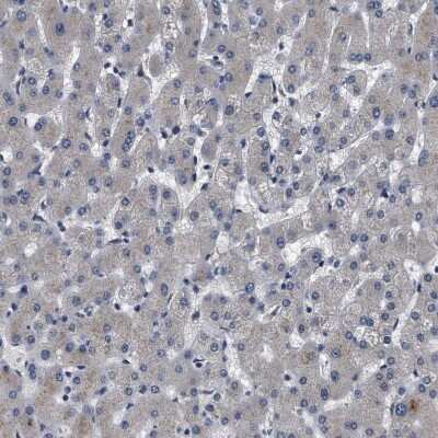 Immunohistochemistry-Paraffin: IFT81 Antibody [NBP1-84558]