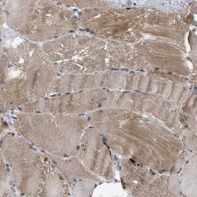 Immunohistochemistry-Paraffin: IFT81 Antibody [NBP1-84558]