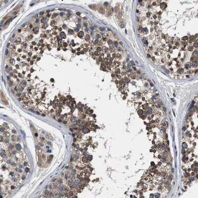 Immunohistochemistry-Paraffin: IFT81 Antibody [NBP1-84558]