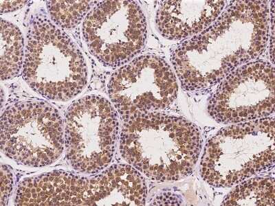 Immunohistochemistry-Paraffin: IFT81 Antibody [NBP2-97511]