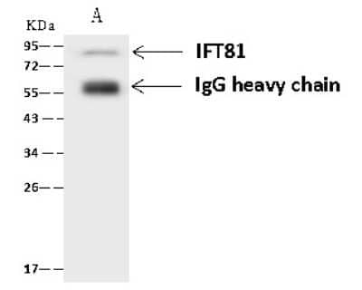 Immunoprecipitation: IFT81 Antibody [NBP2-97511]
