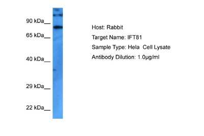 Western Blot: IFT81 Antibody [NBP2-87620]