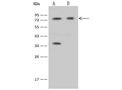 Western Blot: IFT81 Antibody [NBP2-97511]