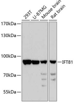 Western Blot: IFT81 AntibodyAzide and BSA Free [NBP3-05102]