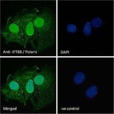 Immunocytochemistry/ Immunofluorescence: IFT88 Antibody [NB100-2475]