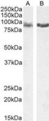 Western Blot: IFT88 Antibody [NB100-2475]