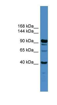 Western Blot: IFT88 Antibody [NBP1-79538]