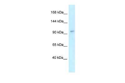 Western Blot: IFT88 Antibody [NBP2-86675]