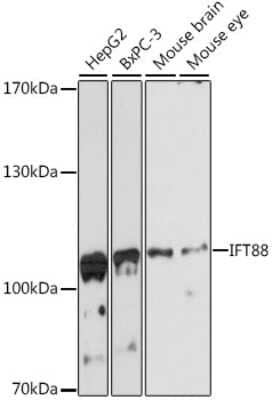 Western Blot: IFT88 AntibodyAzide and BSA Free [NBP3-05094]