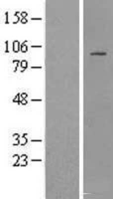 Western Blot: IFT88 Overexpression Lysate [NBL1-11864]