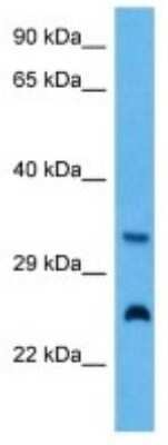 Western Blot: IFTAP Antibody [NBP3-10986]