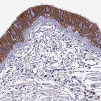 Immunohistochemistry-Paraffin: IGBP1 Antibody [NBP1-83125]