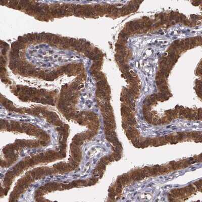 Immunohistochemistry-Paraffin: IGBP1 Antibody [NBP1-83126]