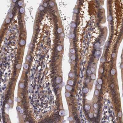 Immunohistochemistry-Paraffin: IGBP1 Antibody [NBP1-83126]