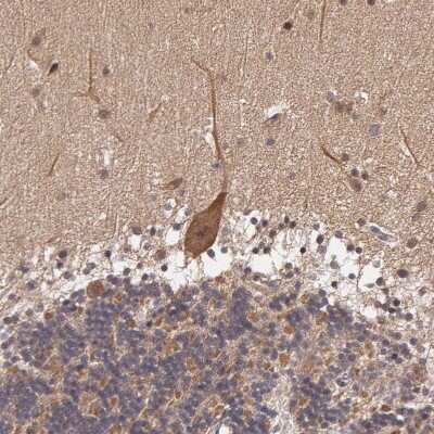 Immunohistochemistry-Paraffin: IGBP1 Antibody [NBP1-83126]