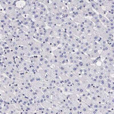 Immunohistochemistry-Paraffin: IGBP1 Antibody [NBP1-83126]