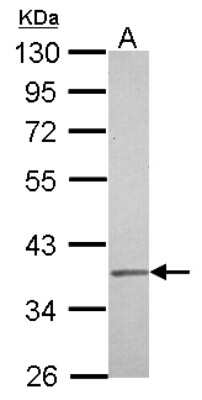 Western Blot: IGBP1 Antibody [NBP2-16928]