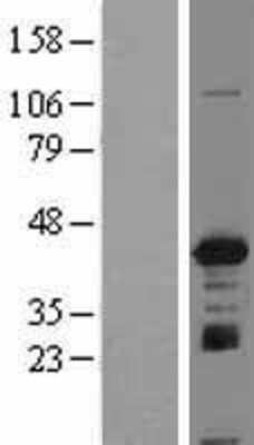 Western Blot: IGBP1 Overexpression Lysate [NBL1-11865]