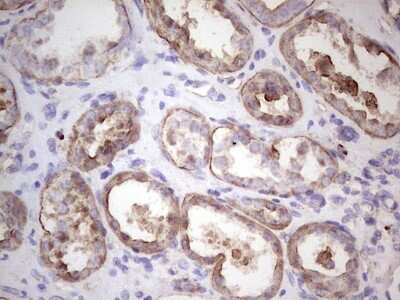 Immunohistochemistry: IGF-I/IGF-1 Antibody (OTI4B12) [NBP2-46037]