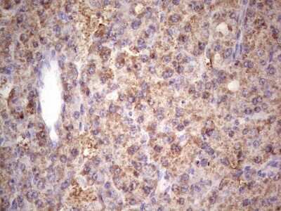 Immunohistochemistry: IGF-I/IGF-1 Antibody (OTI4B12) [NBP2-46037]