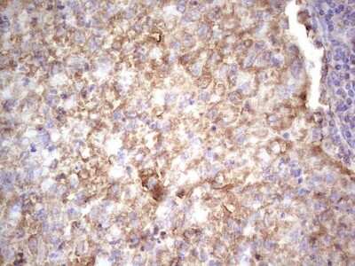 Immunohistochemistry: IGF-I/IGF-1 Antibody (OTI4B12) [NBP2-46037]