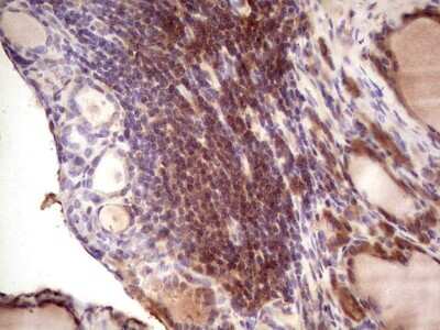 Immunohistochemistry: IGF-I/IGF-1 Antibody (OTI4B12) [NBP2-46037]