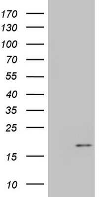 Western Blot: IGF-I/IGF-1 Antibody (OTI4B12) [NBP2-46037]