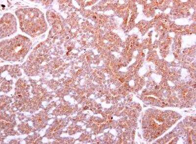 Immunohistochemistry-Paraffin: IGF-I/IGF-1 Antibody [NBP2-16929]