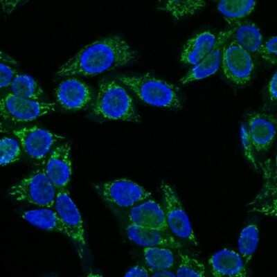 Immunocytochemistry/ Immunofluorescence: IGF-I/IGF-1 Antibody (IGF1/1020) [NBP2-44968]